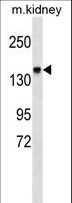 ITGA2 / CD49b Antibody - ITGA2 Antibody western blot of mouse kidney tissue lysates (35 ug/lane). The ITGA2 antibody detected the ITGA2 protein (arrow).