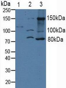 ITGA2 / CD49b Antibody - Western Blot; Sample: Lane1: Human Serum; Lane2: Human 293T Cells; Lane3: Human A431 Cells.