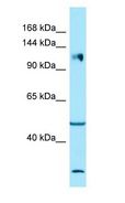 ITGA2 / CD49b Antibody - ITGA2 / CD49b antibody Western Blot of HT1080.  This image was taken for the unconjugated form of this product. Other forms have not been tested.