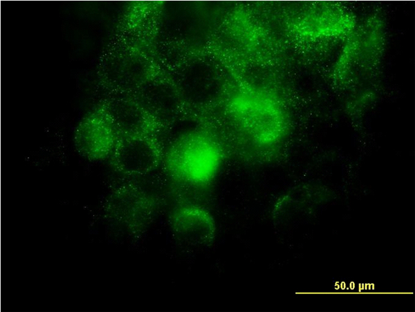 ITGA2 / CD49b Antibody - Immunofluorescence of monoclonal antibody to ITGA2 on A-431 cell. [antibody concentration 10 ug/ml]