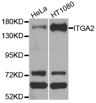 ITGA2 / CD49b Antibody - Western blot analysis of extracts of various cell lines.