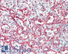 ITGA2B / CD41 Antibody - Anti-ITGA2B  / CD41 antibody IHC staining of human spleen. Immunohistochemistry of formalin-fixed, paraffin-embedded tissue after heat-induced antigen retrieval. Antibody concentration 5 ug/ml.  This image was taken for the unconjugated form of this product. Other forms have not been tested.