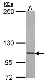 ITGA2B / CD41 Antibody - Sample (30 ug of whole cell lysate). A: A549. 7.5% SDS PAGE. CD41 antibody diluted at 1:500.