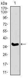ITGA2B / CD41 Antibody - Western blot using ITGA2B monoclonal antibody against human ITGA2B recombinant protein. (Expected MW is 36.9 kDa)