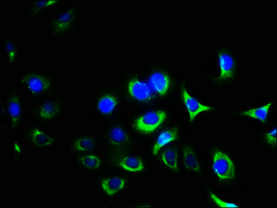 ITGA2B / CD41 Antibody - Immunofluorescence staining of A549 cells with ITGA2B Antibody at 1:400, counter-stained with DAPI. The cells were fixed in 4% formaldehyde, permeabilized using 0.2% Triton X-100 and blocked in 10% normal Goat Serum. The cells were then incubated with the antibody overnight at 4°C. The secondary antibody was Alexa Fluor 488-congugated AffiniPure Goat Anti-Rabbit IgG(H+L).