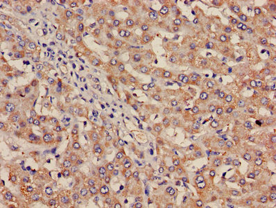 ITGA2B / CD41 Antibody - Immunohistochemistry of paraffin-embedded human spleen tissue using ITGA2B Antibody at dilution of 1:100