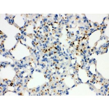 ITGA2B / CD41 Antibody - ITGA2B antibody IHC-paraffin. IHC(P): Rat Lung Tissue.