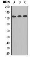 ITGA2B / CD41 Antibody - Western blot analysis of CD41 LC 1 expression in A549 (A); MCF7 (B); PC12 (C) whole cell lysates.