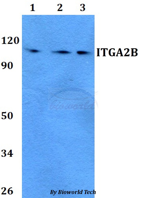 ITGA2B / CD41 Antibody - Western blot of ITGA2B antibody at 1:500 dilution. Lane 1: A549 whole cell lysate. Lane 2: MCF-7 whole cell lysate. Lane 3: PC12 whole cell lysate.