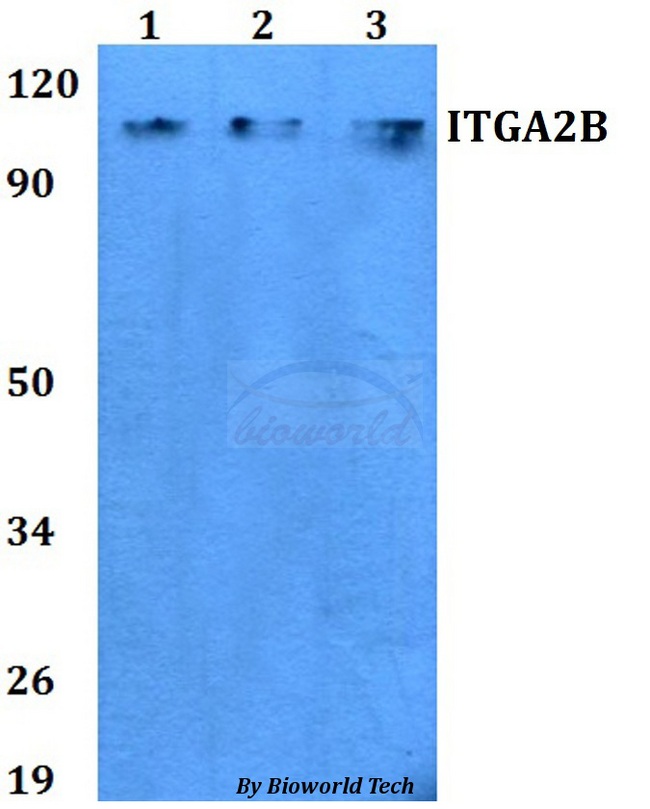 ITGA2B / CD41 Antibody - Western blot of ITGA2B antibody at 1:500 dilution. Lane 1: MCF-7 whole cell lysate. Lane 2: Raw264.7 whole cell lysate. Lane 3: PC12 whole cell lysate.