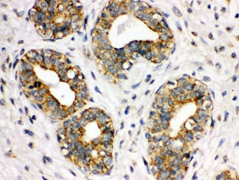 ITGA2B / CD41 Antibody