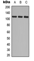 ITGA2B / CD41 Antibody - Western blot analysis of CD41 HC expression in MCF7 (A); Raw264.7 (B); PC12 (C) whole cell lysates.