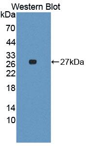ITGA3 / CD49c Antibody - Western blot of ITGA3 / CD49c antibody.