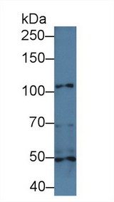 ITGA3 / CD49c Antibody - Western Blot; Sample: Mouse Heart lysate; Primary Ab: 1µg/ml Rabbit Anti-Mouse ITGa3 Antibody Second Ab: 0.2µg/mL HRP-Linked Caprine Anti-Rabbit IgG Polyclonal Antibody