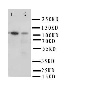 ITGA3 / CD49c Antibody - WB of ITGA3 / CD49c antibody. Lane 1: Rat Heart Tissue Lysate. Lane 2: HELA Cell Lysate.