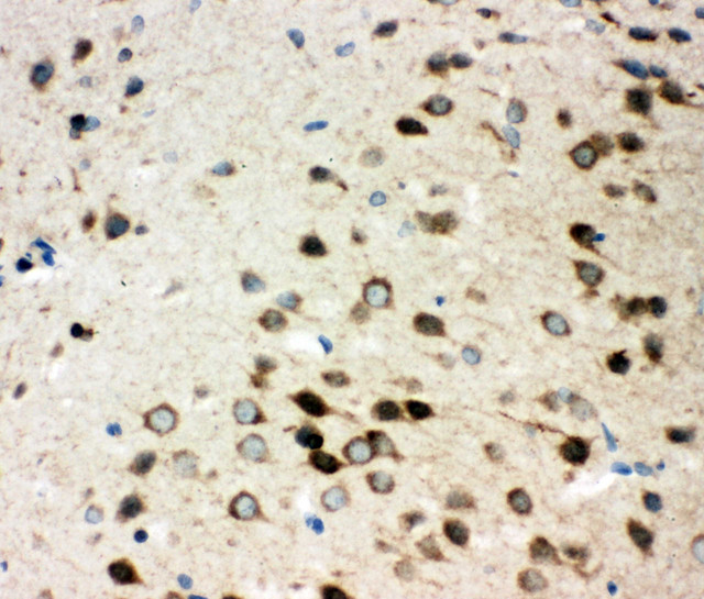 ITGA3 / CD49c Antibody - ITGA3 / CD49c antibody. IHC(P): Rat Brain Tissue.
