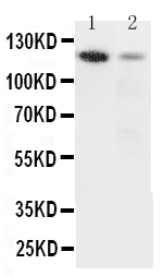 ITGA3 / CD49c Antibody - Anti-Integrin alpha 3 antibody, Western blotting Lane 1: Rat Heart Tissue LysateLane 2: HELA Cell Lysate