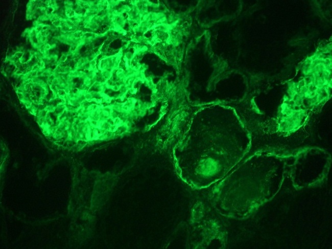 ITGA3 / CD49c Antibody - Immunofluorescent staining on frozen section of human kidney
