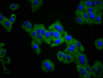 ITGA3 / CD49c Antibody - Immunofluorescence staining of HepG2 cells with ITGA3 Antibody at 1:133, counter-stained with DAPI. The cells were fixed in 4% formaldehyde, permeabilized using 0.2% Triton X-100 and blocked in 10% normal Goat Serum. The cells were then incubated with the antibody overnight at 4°C. The secondary antibody was Alexa Fluor 488-congugated AffiniPure Goat Anti-Rabbit IgG(H+L).