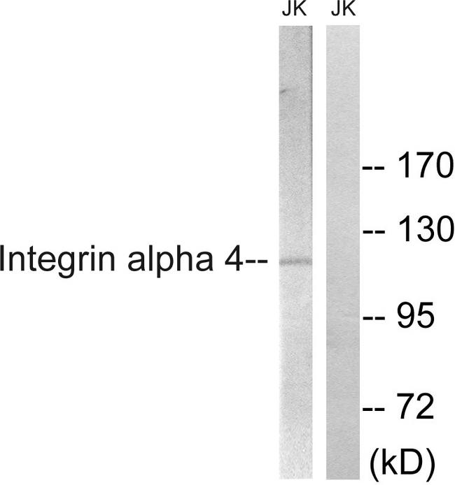 ITGA4 / VLA-4 / CD49d Antibody - Western blot analysis of lysates from Jurkat cells, treated with PMA 125ng/ml 30', using Integrin alpha4 Antibody. The lane on the right is blocked with the synthesized peptide.