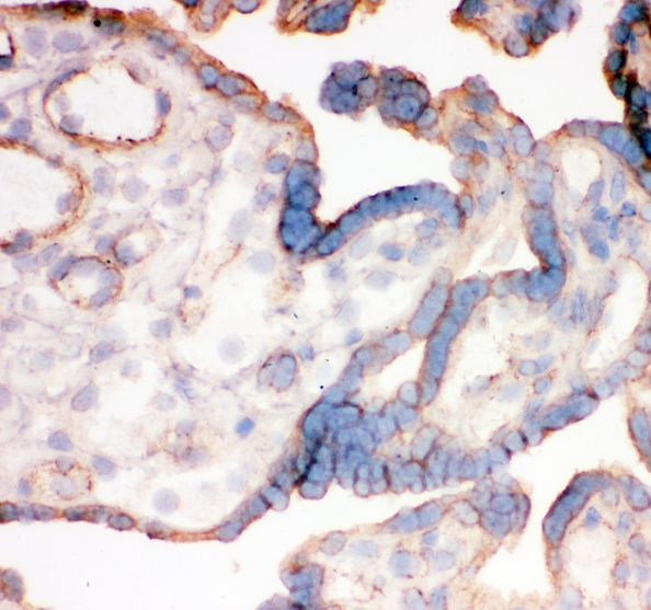 ITGA4 / VLA-4 / CD49d Antibody - IHC analysis of Integrin alpha 4 using anti-Integrin alpha 4 antibody. Integrin alpha 4 was detected in frozen section of human placenta tissues. Heat mediated antigen retrieval was performed in citrate buffer (pH6, epitope retrieval solution) for 20 mins. The tissue section was blocked with 10% goat serum. The tissue section was then incubated with 1µg/ml rabbit anti-Integrin alpha 4 Antibody overnight at 4°C. Biotinylated goat anti-rabbit IgG was used as secondary antibody and incubated for 30 minutes at 37°C. The tissue section was developed using Strepavidin-Biotin-Complex (SABC) with DAB as the chromogen.