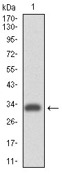 ITGA4 / VLA-4 / CD49d Antibody - Western blot using ITGA4 monoclonal antibody against human ITGA4 (AA: 926-978) recombinant protein. (Expected MW is 31.7 kDa)