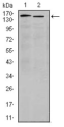 ITGA4 / VLA-4 / CD49d Antibody - Western blot using ITGA4 mouse monoclonal antibody against K562(1) and Jurkat (2) cell lysate.