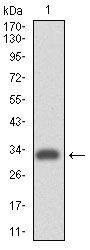 ITGA4 / VLA-4 / CD49d Antibody - ITGA4 Antibody in Western Blot (WB)