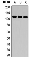 ITGA4 / VLA-4 / CD49d Antibody - Western blot analysis of CD49d expression in HEK293T (A); Raw264.7 (B); H9C2 (C) whole cell lysates.