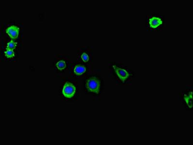 ITGA4 / VLA-4 / CD49d Antibody - Immunofluorescent analysis of HepG2 cells diluted at 1:100 and Alexa Fluor 488-congugated AffiniPure Goat Anti-Rabbit IgG(H+L)