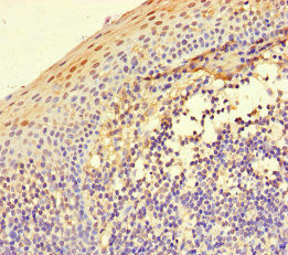 ITGA4 / VLA-4 / CD49d Antibody - Immunohistochemistry of paraffin-embedded human tonsil tissue at dilution of 1:100