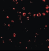 ITGA4 / VLA-4 / CD49d Antibody - Immunofluorescence of Integrin alpha 4 in Jurkat cells with Integrin alpha 4 antibody at 2 ug/ml.