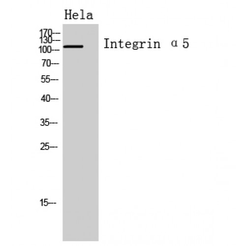 ITGA5/Integrin Alpha 5/CD49e Antibody - Western blot of Integrin alpha5 antibody
