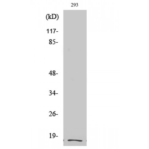 ITGA5/Integrin Alpha 5/CD49e Antibody - Western blot of Cleaved-Integrin alpha5 LC (E895) antibody