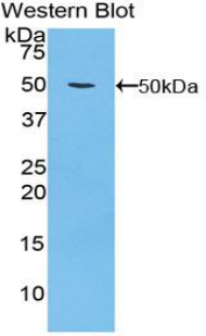 ITGA5/Integrin Alpha 5/CD49e Antibody - Western blot of recombinant ITGA5/Integrin Alpha 5/CD49e.  This image was taken for the unconjugated form of this product. Other forms have not been tested.