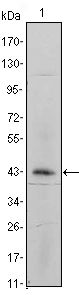 ITGA5/Integrin Alpha 5/CD49e Antibody - ITGA5 Antibody in Western Blot (WB)