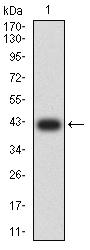 ITGA5/Integrin Alpha 5/CD49e Antibody - Western blot analysis using CD49E mAb against human CD49E (AA: extra 111-253) recombinant protein. (Expected MW is 41.8 kDa)