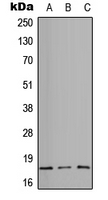 ITGA5/Integrin Alpha 5/CD49e Antibody - Western blot analysis of CD49e HC expression in HEK293T (A); Raw264.7 (B); PC12 (C) whole cell lysates.