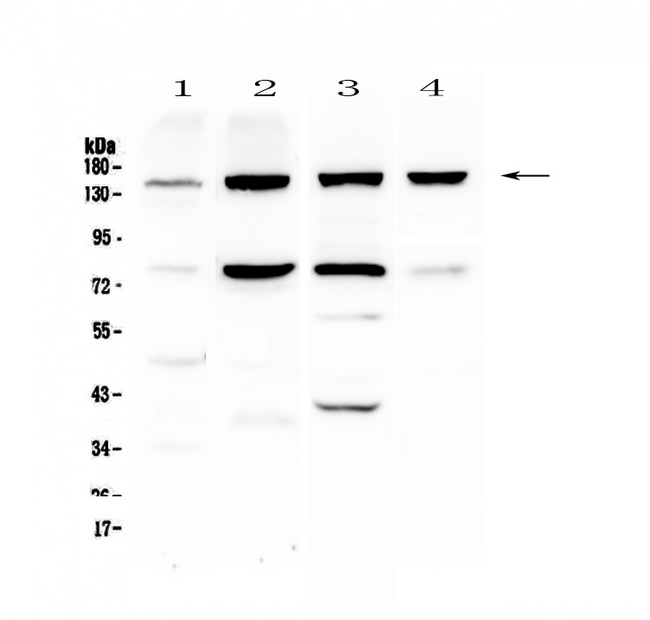 ITGA5/Integrin Alpha 5/CD49e Antibody - Western blot - Anti-Integrin alpha 5 Picoband antibody