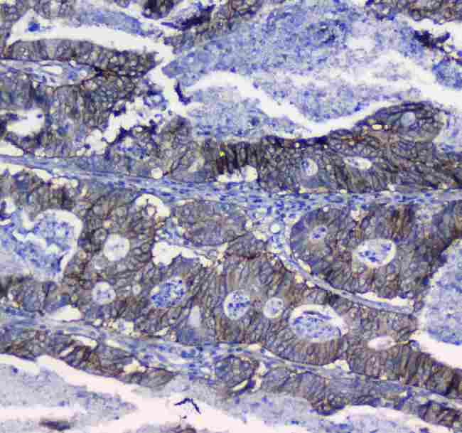 ITGA5/Integrin Alpha 5/CD49e Antibody - Immunohistochemistry - Anti-Integrin alpha 5 Picoband antibody