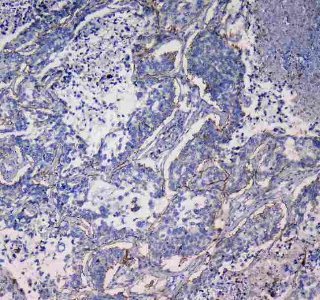 ITGA5/Integrin Alpha 5/CD49e Antibody - Immunohistochemistry - Anti-Integrin alpha 5 Picoband antibody