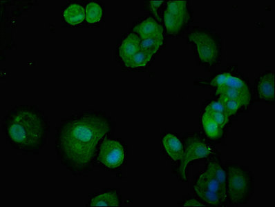 ITGA5/Integrin Alpha 5/CD49e Antibody - Immunofluorescent analysis of MCF-7 cells at a dilution of 1:100 and Alexa Fluor 488-congugated AffiniPure Goat Anti-Rabbit IgG(H+L)