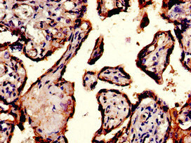 ITGA5/Integrin Alpha 5/CD49e Antibody - Immunohistochemistry image of paraffin-embedded human placenta tissue at a dilution of 1:100