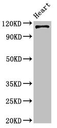 ITGA5/Integrin Alpha 5/CD49e Antibody - Positive Western Blot detected in Mouse heart tissue. All lanes: ITGA5 antibody at 4 µg/ml Secondary Goat polyclonal to rabbit IgG at 1/50000 dilution. Predicted band size: 115 KDa. Observed band size: 115 KDa