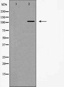 ITGA5/Integrin Alpha 5/CD49e Antibody - Western blot analysis of Integrin a5 (CD49e) expression in HeLa cells. The lane on the left is treated with the antigen-specific peptide.