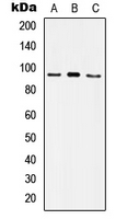ITGA5/Integrin Alpha 5/CD49e Antibody - Western blot analysis of CD49e HC expression in HeLa (A); Raw264.7 (B); PC12 (C) whole cell lysates.