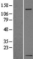 ITGA5/Integrin Alpha 5/CD49e Protein - Western validation with an anti-DDK antibody * L: Control HEK293 lysate R: Over-expression lysate