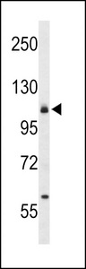 ITGA6/Integrin Alpha 6/CD49f Antibody - Western blot of CD49f Antibody in 293 cell line lysates (35 ug/lane). CD49f (arrow) was detected using the purified antibody.