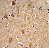 ITGA6/Integrin Alpha 6/CD49f Antibody - Formalin-fixed and paraffin-embedded human brain tissue reacted with CD49f Antibody , which was peroxidase-conjugated to the secondary antibody, followed by DAB staining. This data demonstrates the use of this antibody for immunohistochemistry; clinical relevance has not been evaluated.