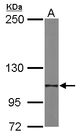 ITGA6/Integrin Alpha 6/CD49f Antibody - Sample (20 ug of whole cell lysate). A: human ESC. 5% SDS PAGE. ITGA6 / CD49f antibody diluted at 1:2000.